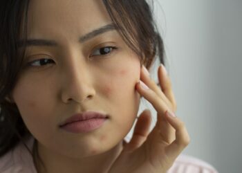 濕疹的類型有很多，通常症狀一出現，動輒要好幾個禮拜才可能痊癒。究竟，為什麼炎熱的夏天一到，身體就開始長濕疹或汗皰疹呢？我們又該怎麼預防惱人的濕疹與汗皰疹呢？