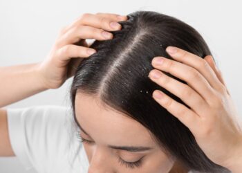 為什麼洗完頭還有頭皮屑？分享5大頭皮屑原因！