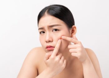 清除黑頭粉刺的6大重點！粉刺清潔後的保養也很重要