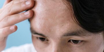 「臉部脫屑」不只是乾燥！翰醫堂譚溥瑞中醫師深入解析中醫四大脫屑類型、教你快速自我檢測，並分享專業辯證調理與日常飲食、穴道按摩等4大改善撇步，助你從根本解決皮膚問題，告別乾癢，重拾健康水潤肌。